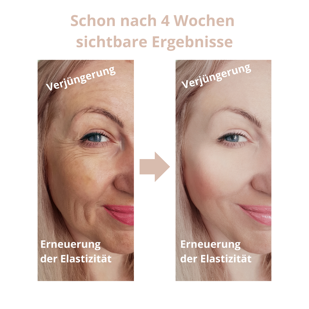 Anti-Aging Gesichtsmassagegerät für ein strahlendes Aussehen