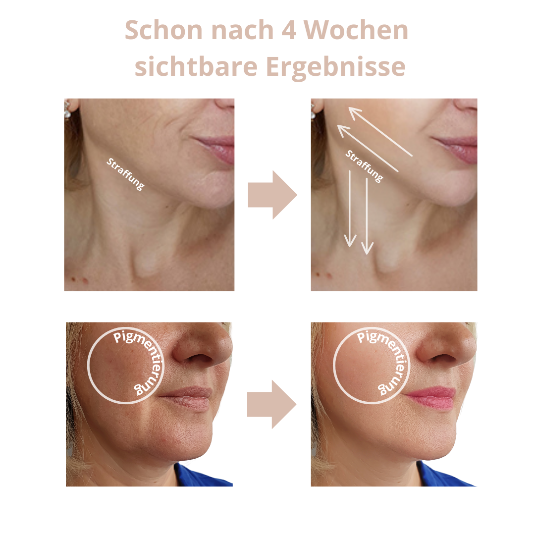 Anti-Aging Gesichtsmassagegerät für ein strahlendes Aussehen