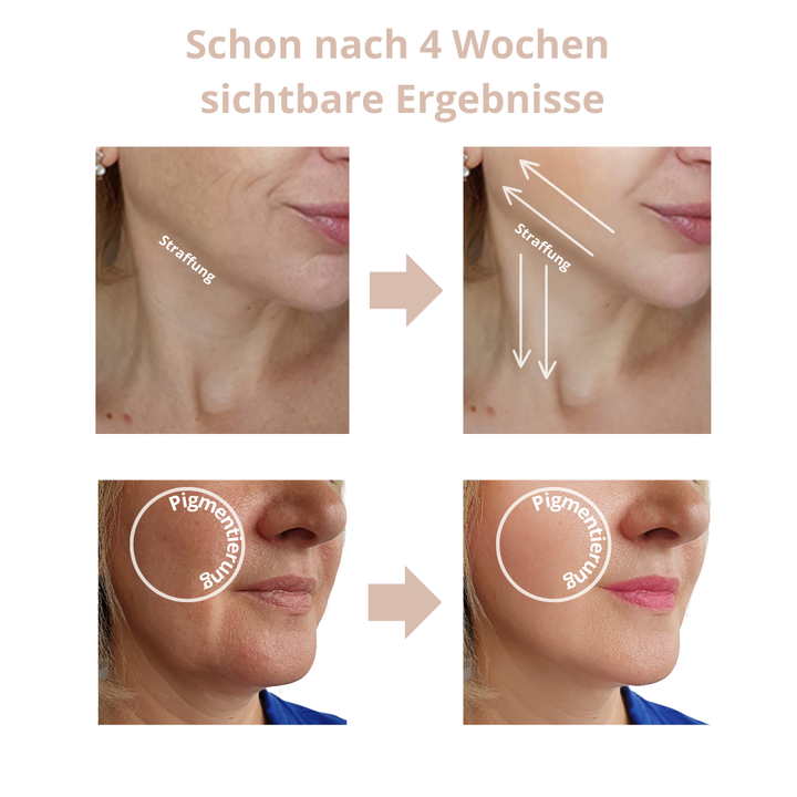 Anti-Aging Gesichtsmassagegerät für ein strahlendes Aussehen